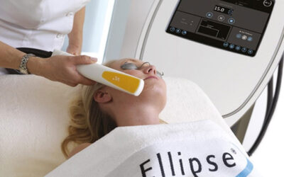 Nuevo tratamiento ELLIPSE